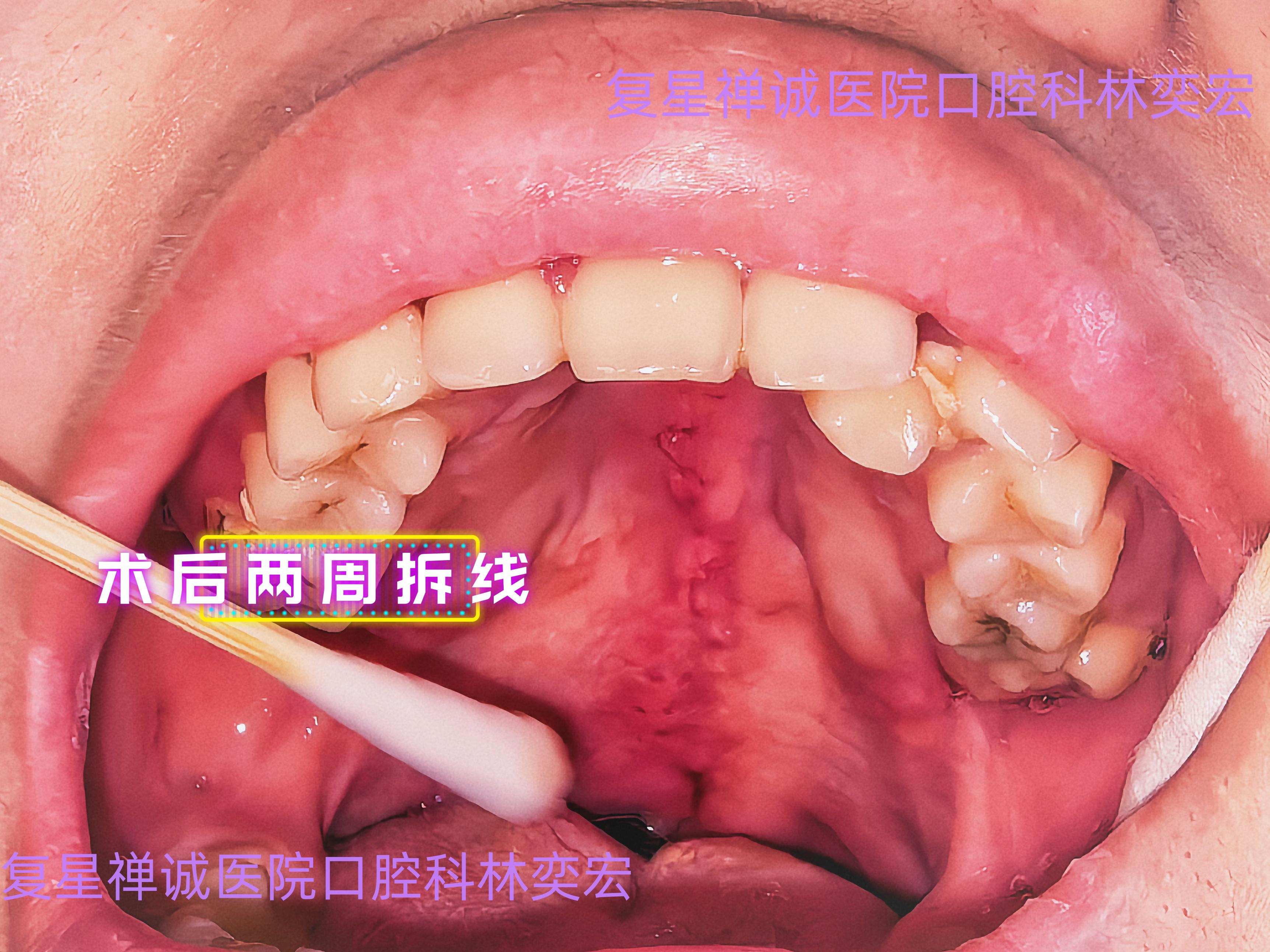 种植细节