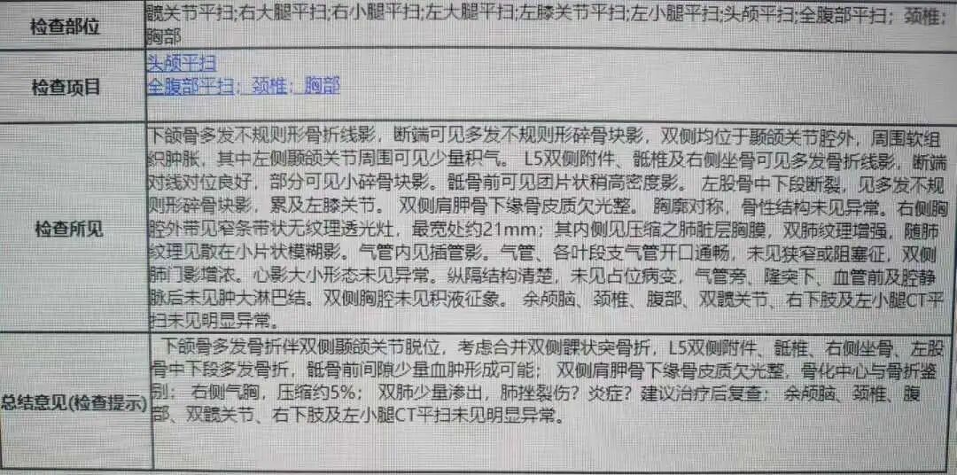 颌面部CT三维重建