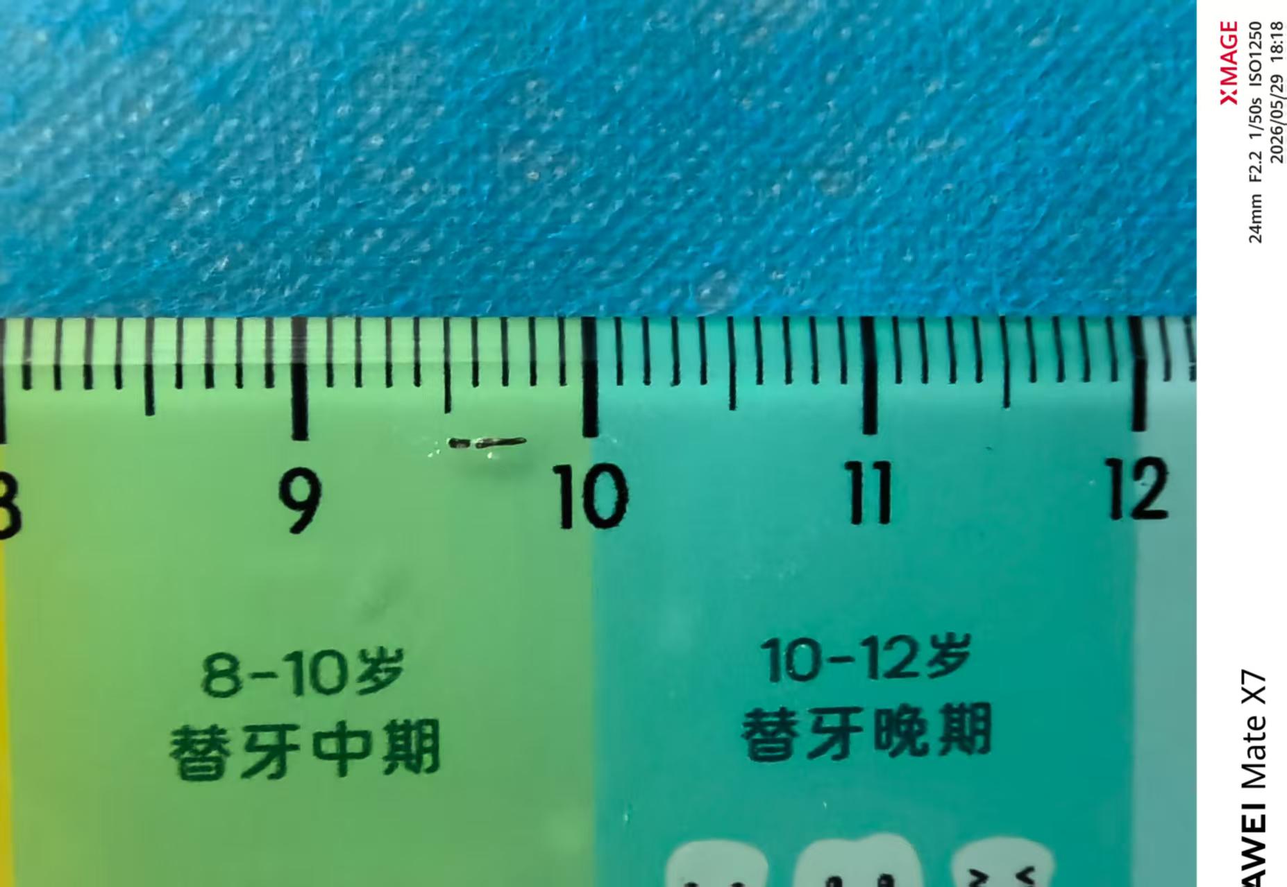 贴面修复术前