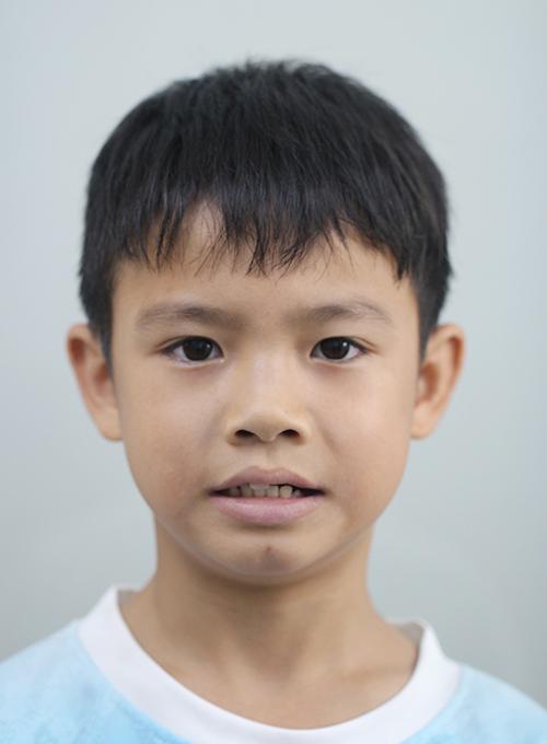 治疗过程