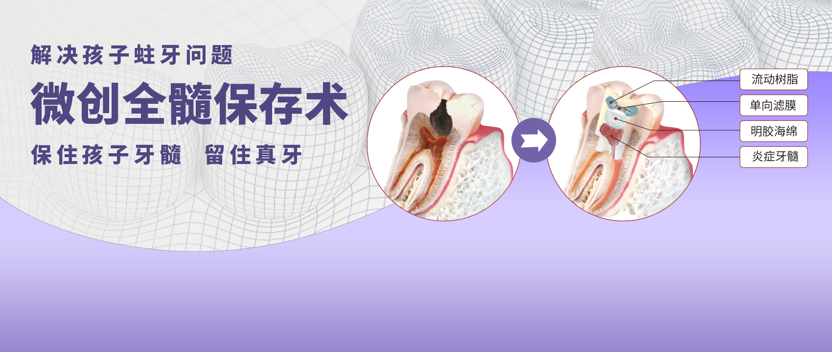 “能保则保”，先帮您留住真牙